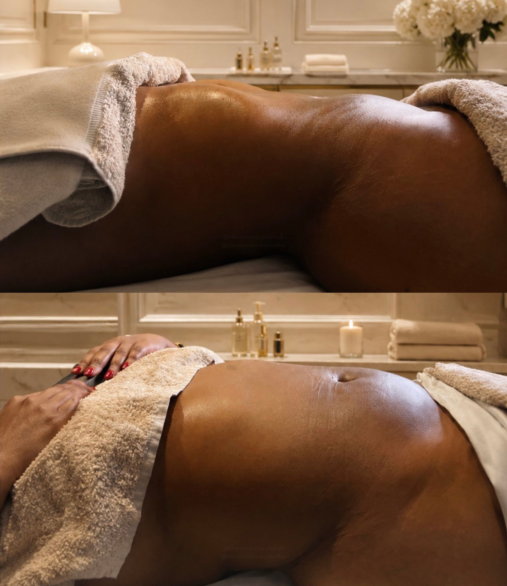 Before and after body sculpting at The Natural Sculpt, London