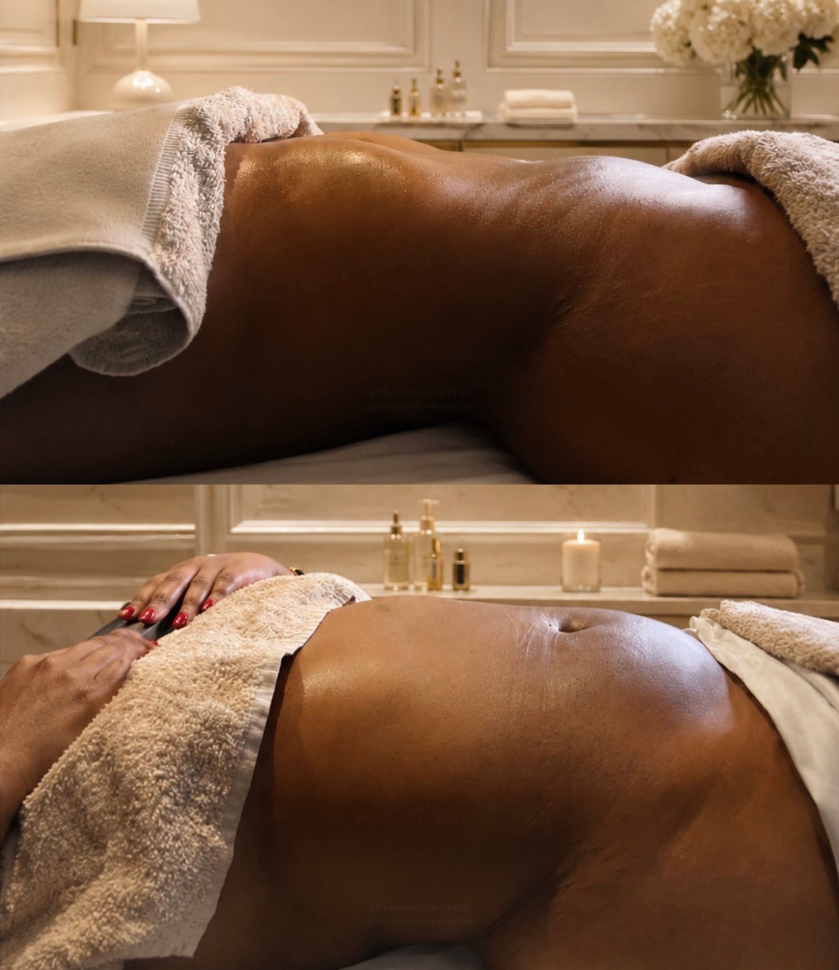 Post-operative lymphatic drainage session in a calm treatment room