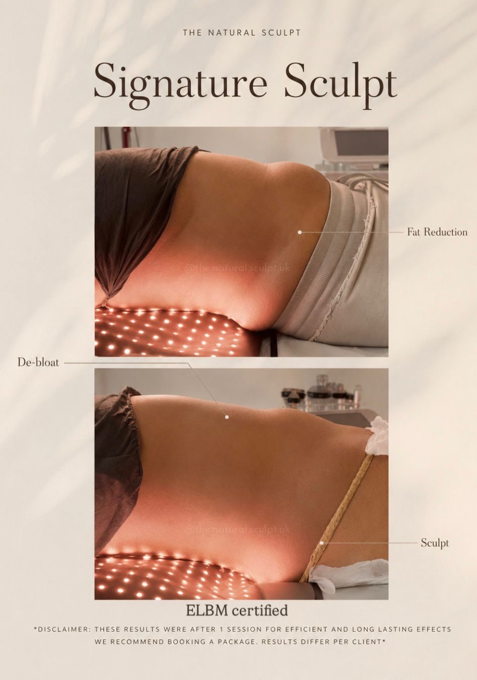 Signature Sculpt session at The Natural Sculpt, London